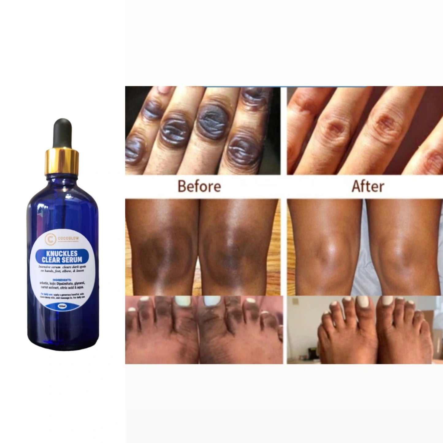 Knuckles Clear Serum
