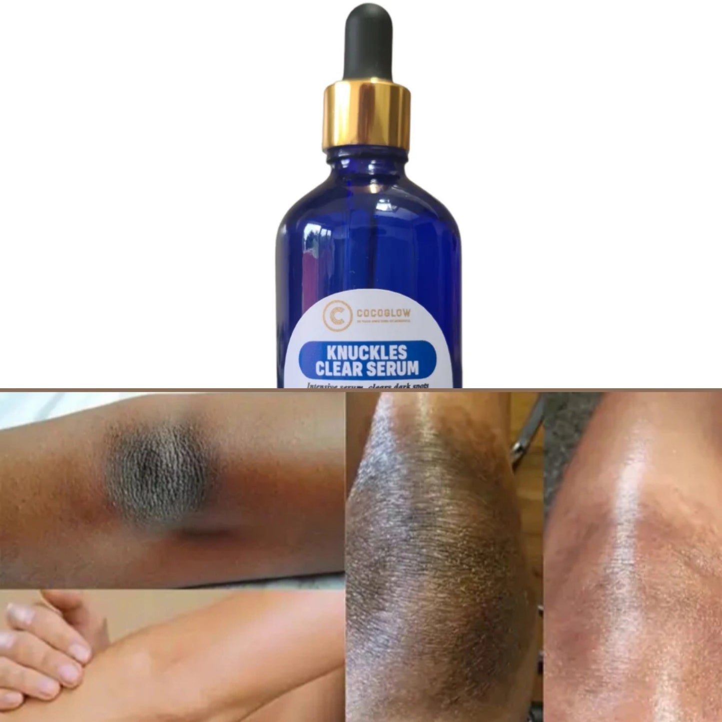 Knuckles Clear Serum