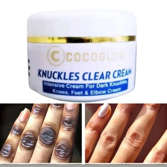 Knuckles clear cream